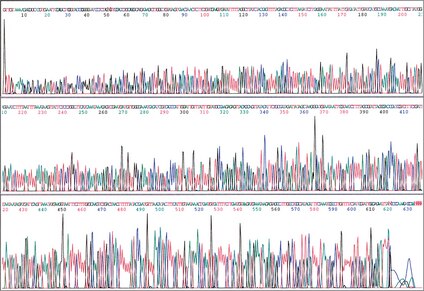 Un producto de PCR de 657 pb (10 fmoles) se purificó usando la placa de filtración Montage PCR<sub>µ96</sub> y se secuenció en una reacción 1/8 x BigDye Terminator v1.1. Después de la purificación con el kit Montage SEQ<sub>96</sub> para purificación de la reacción de secuenciación, las muestras se analizaron en el secuenciador de ADN ABI PRISM 3700. Usando este método, la primera base después del 